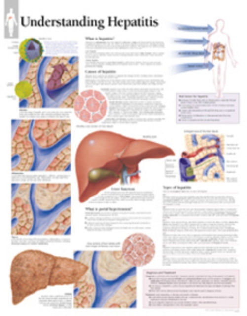 Book cover of: Understanding Hepatitis Paper Poster