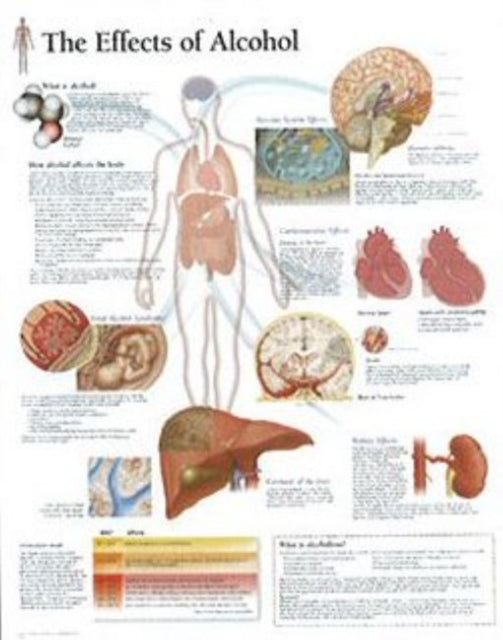 Book cover of: Effects of Alcohol Laminated Poster