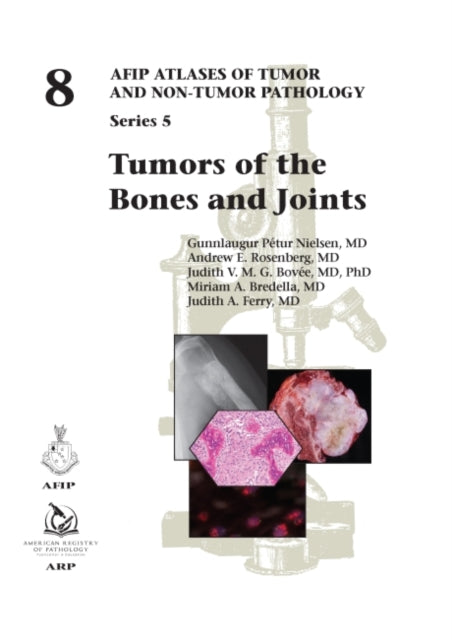 Book cover of: Tumors of the Bones and Joints. By: Gunnlaugur Pétur Nielsen