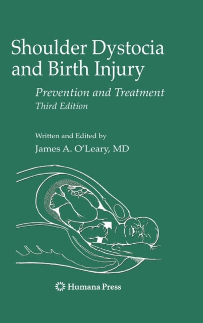 Book cover of: Shoulder Dystocia and Birth Injury. By: James A. O'Leary