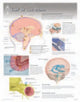 Book cover of: CSF & the Brain Laminated Poster
