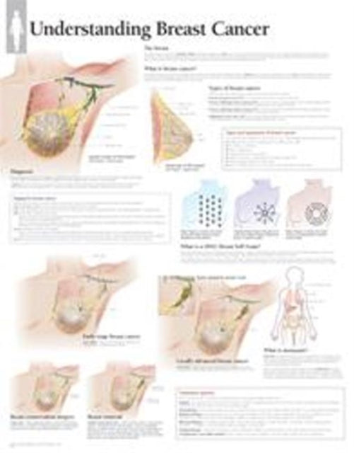 Book cover of: Understanding Breast Cancer Paper Poster