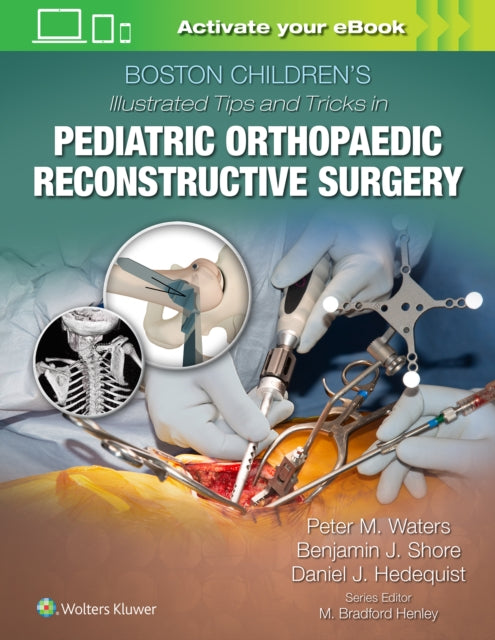 Book cover of: Boston Children's Illustrated Tips and Tricks in Pediatric Orthopaedic Reconstructive Surgery. By: Waters