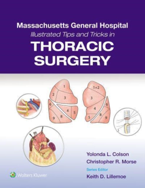 Book cover of: Massachusetts General Hospital Illustrated Tips and Tricks in Thoracic Surgery: Print + eBook with Multimedia. By: Yolonda Colson
