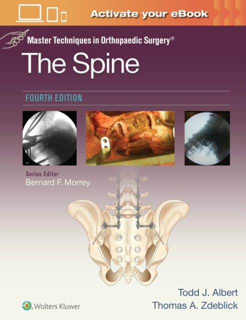 Book cover of: Master Techniques in Orthopaedic Surgery: The Spine. By: Todd Albert