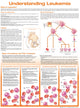 Book cover of: Understanding Leukemia Anatomical Chart