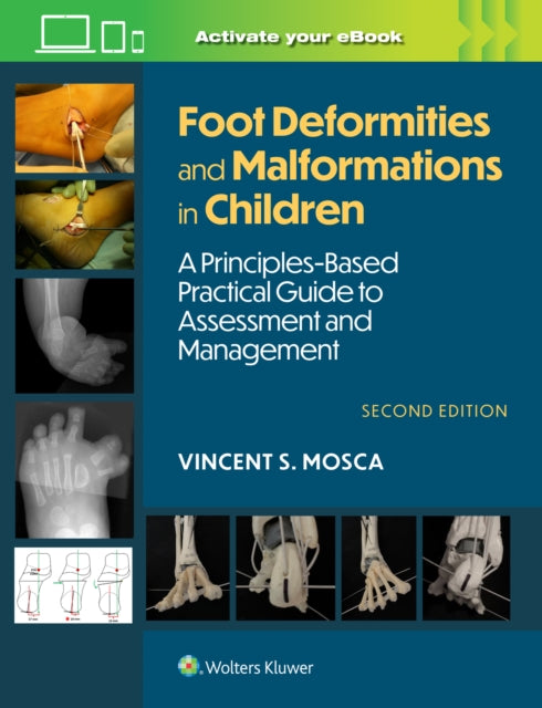 Book cover of: Foot Deformities and Malformations in Children. By: Vincent Mosca