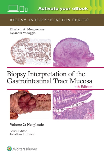 Book cover of: Biopsy Interpretation of the Gastrointestinal Tract Mucosa Volume 2. By: Elizabeth Anne MONTGOMERY