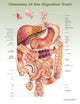 Book cover of: Diseases of the Digestive Tract Anatomical Chart. By: Anatomical Chart Company