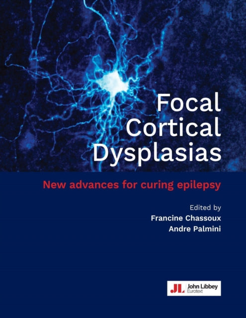 Book cover of: Focal Cortical Dysplasias. By: Francine Chassoux