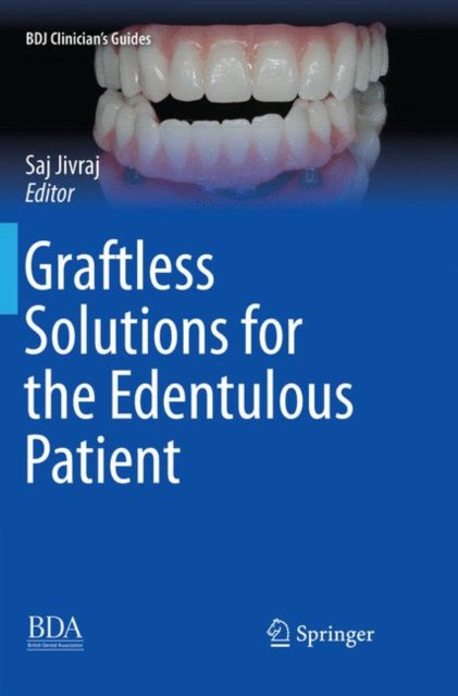 Book cover of: Graftless Solutions for the Edentulous Patient