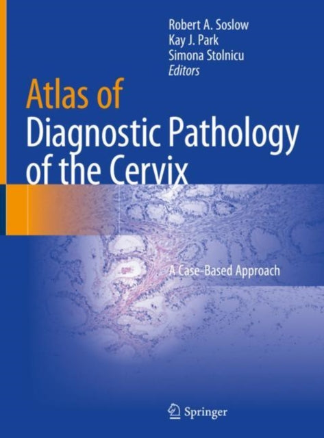 Book cover of: Atlas of Diagnostic Pathology of the Cervix. By: Robert A. Soslow