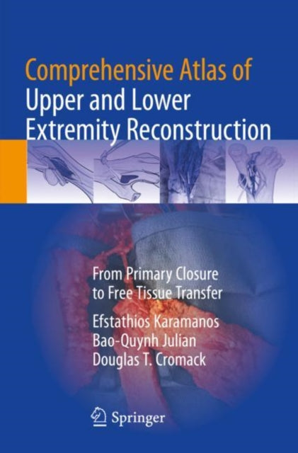 Book cover of: Comprehensive Atlas of Upper and Lower Extremity Reconstruction. By: Efstathios Karamanos