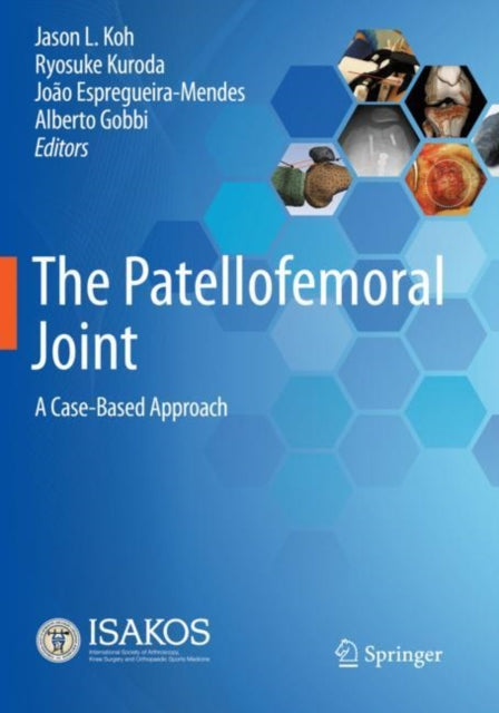 Book cover of: Patellofemoral Joint. By: Jason L. Koh