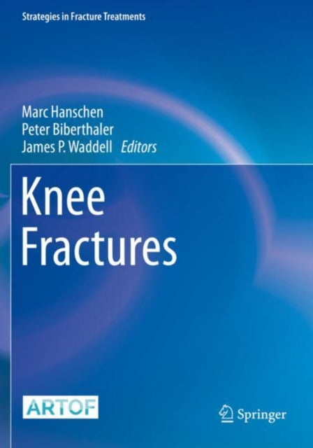 Book cover of: Knee Fractures. By: Marc Hanschen