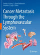 Book cover of: Cancer Metastasis Through the Lymphovascular System. By: Stanley P. Leong
