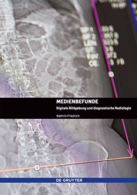 Book cover of: Medienbefunde. By: Kathrin Friedrich