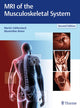 Book cover of: MRI of the Musculoskeletal System. By: Martin Vahlensieck