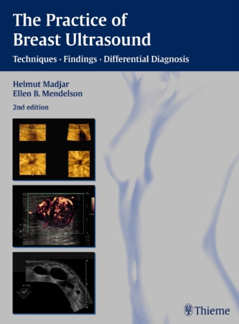 Book cover of: Practice of Breast Ultrasound. By: H. Madjar