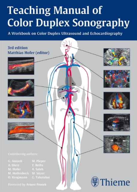 Book cover of: Teaching Manual of Color Duplex Sonography. By: Matthias Hofer