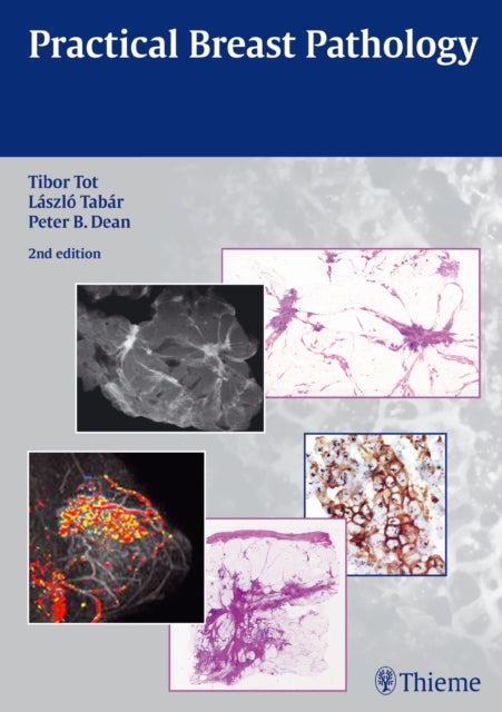 Book cover of: Practical Breast Pathology. By: Tibor Tot