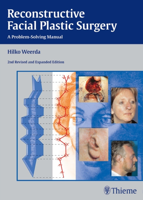 Book cover of: Reconstructive Facial Plastic Surgery. By: Hilko Weerda