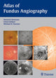 Book cover of: Atlas of Fundus Angiography. By: Heinrich, M.D. Heimann