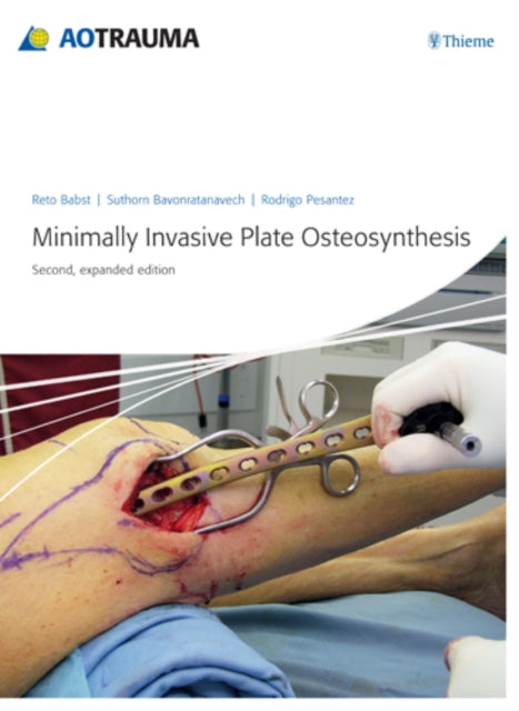 Book cover of: Minimally Invasive Plate Ostheosynthesis. By: Reto Babst