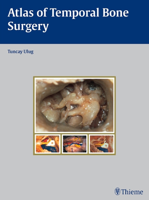 Book cover of: Atlas of Temporal Bone Surgery. By: Tuncay Ulug