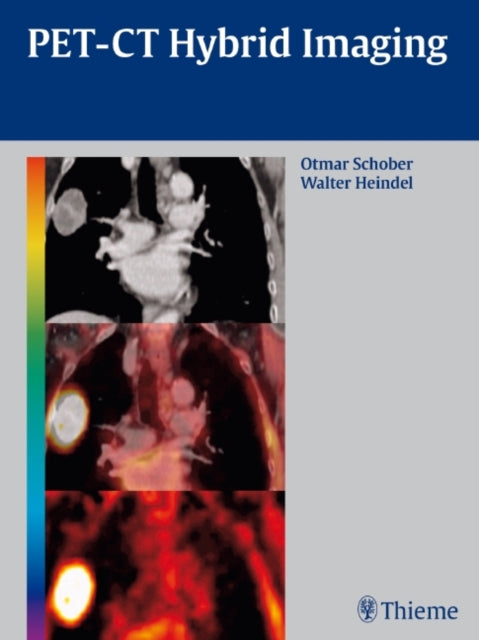 Book cover of: PET-CT Hybrid Imaging. By: Otmar Schober