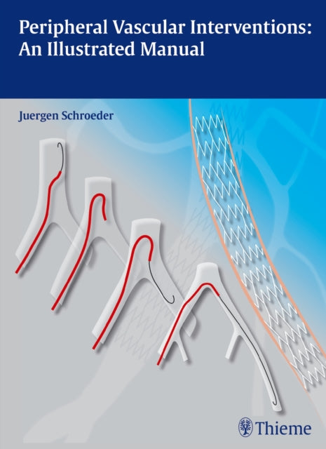Book cover of: Peripheral Vascular Interventions: an Illustrated Manual. By: Juergen Schroeder