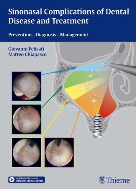 Book cover of: Sinonasal Complications of Dental Disease and Treatment. By: Giovanni Felisati