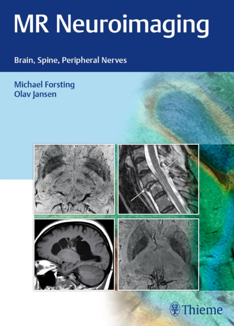 Book cover of: MR Neuroimaging. By: Michael Forsting