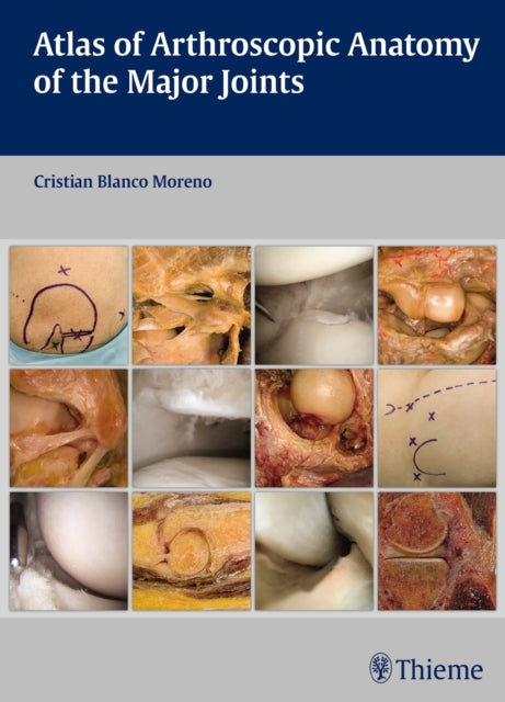 Book cover of: Atlas of Arthroscopic Anatomy of the Major Joints. By: Cristian Blanco Moreno