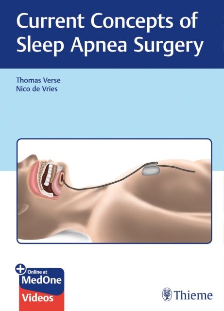 Book cover of: Current Concepts of Sleep Apnea Surgery. By: Filippo Montevecchi