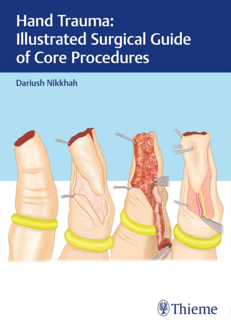 Book cover of: Hand Trauma: Illustrated Surgical Guide of Core Procedures. By: Dariush Nikkhah