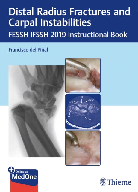 Book cover of: Distal Radius Fractures and Carpal Instabilities. By: Francisco del Pinal