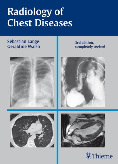 Book cover of: Radiology of Chest Diseases. By: Sebastian Lange