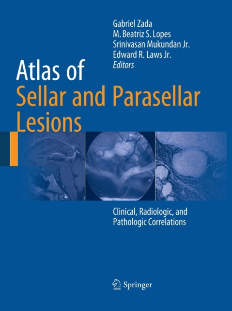 Book cover of: Atlas of Sellar and Parasellar Lesions. By: Gabriel Zada