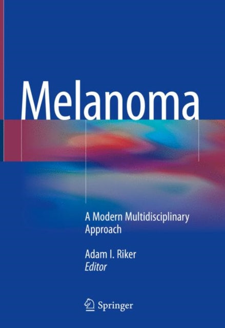 Book cover of: Melanoma