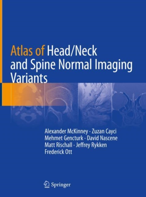 Book cover of: Atlas of Head/Neck and Spine Normal Imaging Variants. By: Alexander McKinney