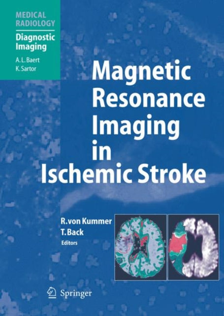 Book cover of: Magnetic Resonance Imaging in Ischemic Stroke