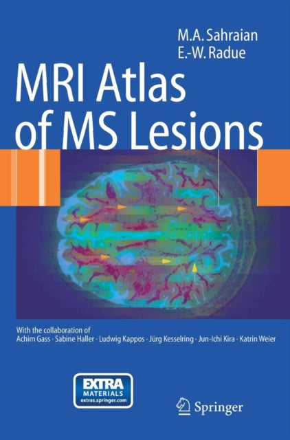 Book cover of: MRI Atlas of MS Lesions. By: E. W. Radü