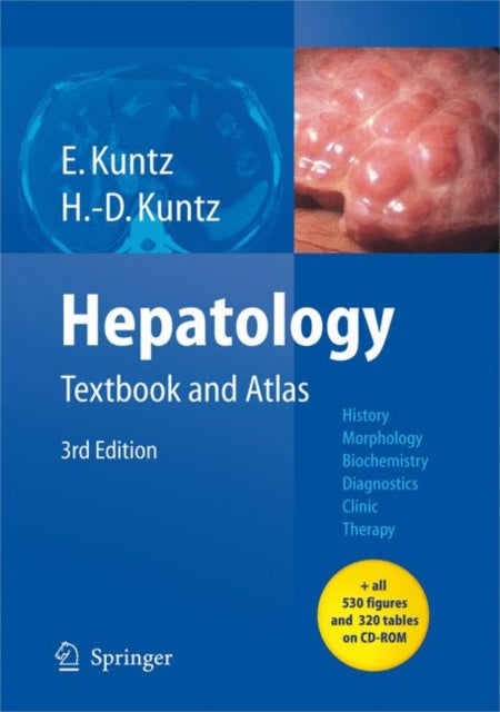 Book cover of: Hepatology. By: Erwin Kuntz