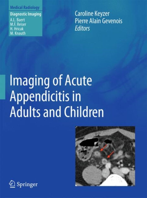 Book cover of: Imaging of Acute Appendicitis in Adults and Children