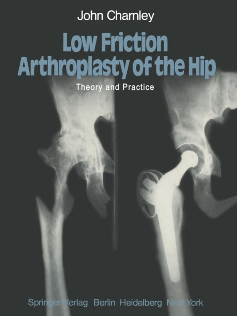 Book cover of: Low Friction Arthroplasty of the Hip. By: J. Charnley