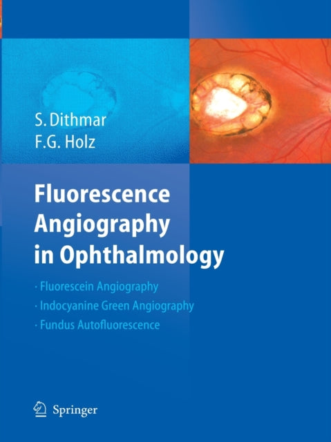 Book cover of: Fluorescence Angiography in Ophthalmology. By: Stefan Dithmar