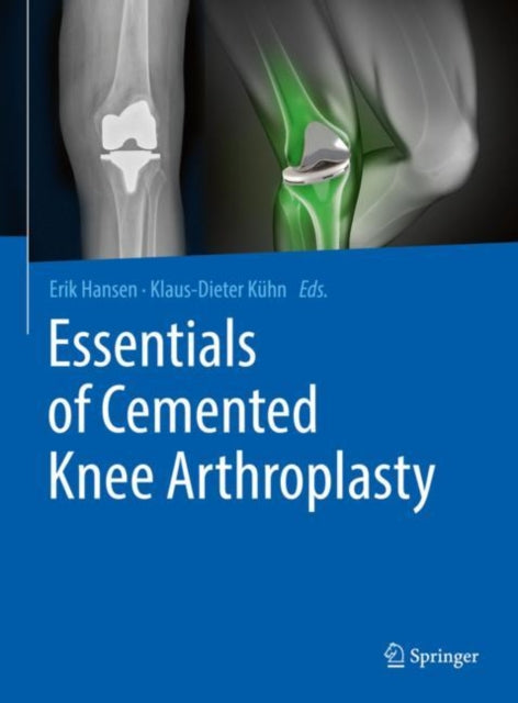 Book cover of: Essentials of Cemented Knee Arthroplasty. By: Erik Hansen