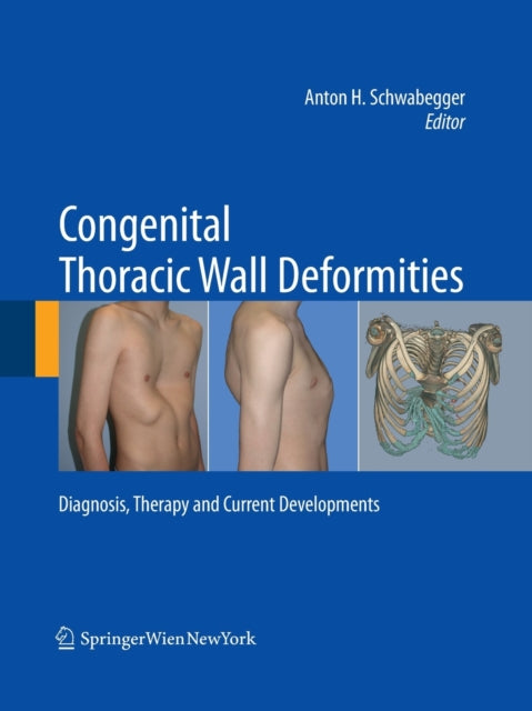 Book cover of: Congenital Thoracic Wall Deformities. By: Anton H. Schwabegger