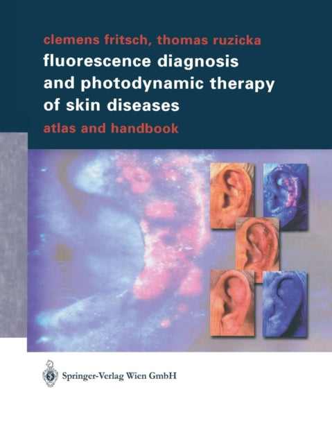 Book cover of: Fluorescence Diagnosis and Photodynamic Therapy of Skin Diseases. By: Clemens Fritsch